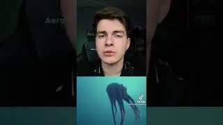 руки из жопы и глаза на жопе и жопа с ушами и голова в жопе ну ничего живёт и не жалуется 