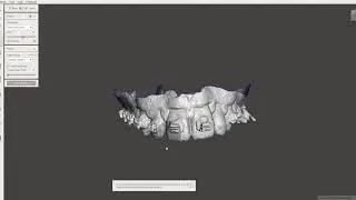 How to remove brackets virtually in meshmixer