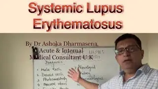 Systemic Lupus Erythematosus