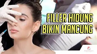 Filler Hidung bikin mancung