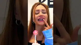 did you wear braces?❤️🥹#tiktok #reaction #prank #shocked