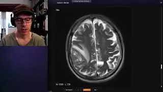 How to use Radiopaedia to teach