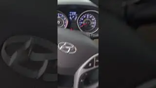 Hyundai elantra RPM Randomly Dies Quick Fix