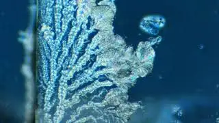 Vitamin C crystals time lapse with cross polarized light