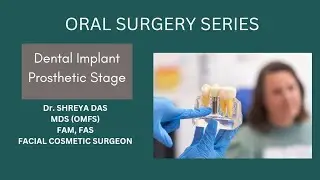 Dental Implant Prosthetic Stage | Impression Coping