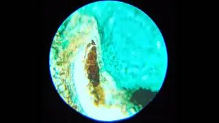 Cell Phone Adapter for Microscope Test#4