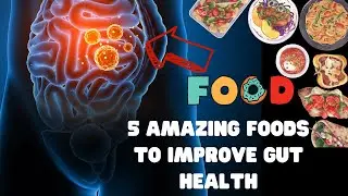 5 Amazing Foods to Improve Gut Health
