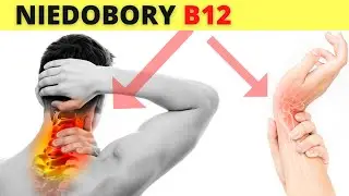 10 Symptoms of Vitamin B12 Deficiency You MUST Know