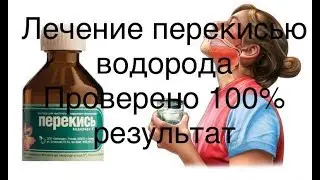 Лечение болезней перекисью  Результат 100%.  Доверяй Но проверяй.