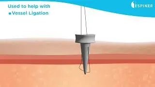SuitORpass disposable suture passer and guide