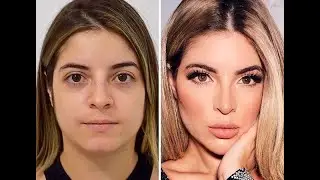 Gkay Antes e Depois