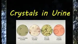 Urine Examination(3)-- Crystals