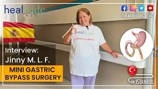 MGB | Mini Gastric Bypass | Jinny's Experiences from España | OBESITY SURGERY in TURKEY