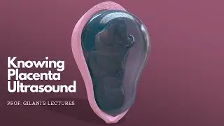 Knowing Placenta on Ultrasound - Animated | Prof. Gilani's Lectures |