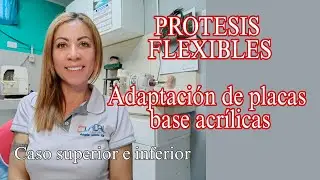 Recorte y adaptación de placas base en modelos Duplicados para PROTESIS FLEXIBLES caso sup/inf