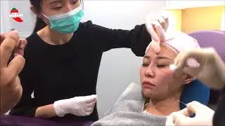 Premier Clinic - KL City ( Derma Filler for Under Eye)