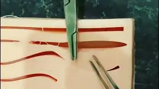 косметический, внутрикожный шов, как накладывать \ cosmetic, intradermal suture, how to apply