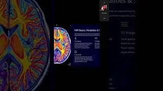 MRI & Ultrasound || best imaging techniques