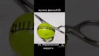 Израильские хирурги #shorts