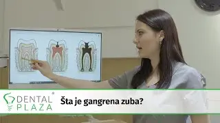 Šta je gangrena zuba?