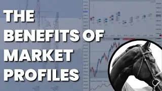 The Benefits of Market Profiles