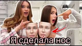 WHY I DECIDED TO HAVE RHINOPLASTY? MY HONEST STORY