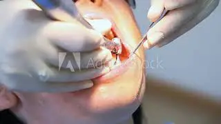 Dentist doing a dental cleaning for a cute smile