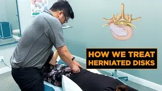 How We Treat a Herniated Disk | Physical Therapy