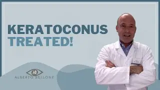 I Treated My Keratoconus! Patient Testimony