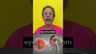 Visual Snow and vision problems can be a structural neck problem #neckinstability #cervicalspine