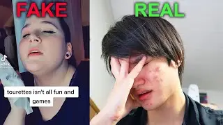 Guy with Real Tourettes Reacts to Tiktoker Faking Tourettes