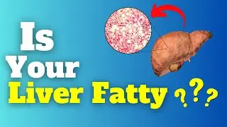 7 Warning Signs that Your Liver is Fatty