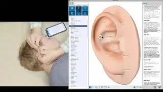 Auriculotherapy With Auriculo360 In Your Home!