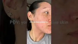 The struggles of trying out new skincare products 🥲 #skincare #skin