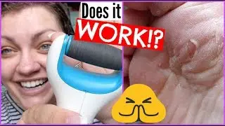 Amope Pedi Perfect Electronic Foot File | Demo, Results, & Review!