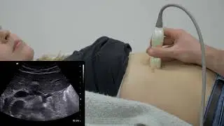 Abdomensonografie - Pankreas