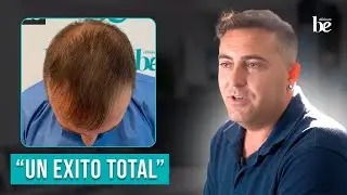 🌟 José Ángel Comparte su Éxito con Injerto Capilar en Clínicas Be, Granada | Testimonio Inspirador 🌟