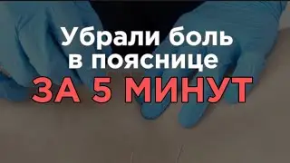 Быстрый метод от боли в спине.Обкалывание триггерных точек.Метод Сухой иглы
