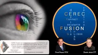 CEREC Fusion