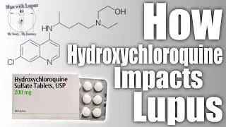 Hydroxychloroquine Unveiled: A Deep Dive into Its Impact on Lupus