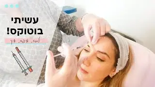 עשיתי בוטוקס!