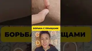 Борьба с прыщами: вмешиваться или подождать? 🤔