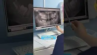 НЕ ХВАТАЕТ МЕСТА ЗУБУ! 🫣 прием у ортодонта 