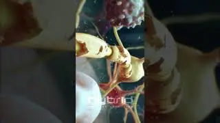 Multiple sclerosis (MS) animation | myelin sheath destruction | medical animation | MS animation