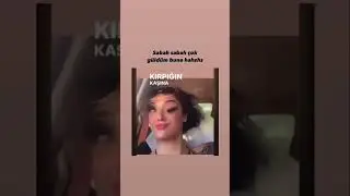 KAŞI GÖZÜ AYRI OYNUYOR 😂