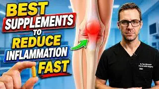 11 Best Supplements for Osteoarthritis & Joint Pain!