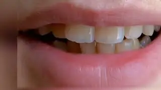 Natural Remedy  For Healthy Teeth & Bones From Eggshell
