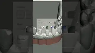 Changing it up! (Meshmixer Background)