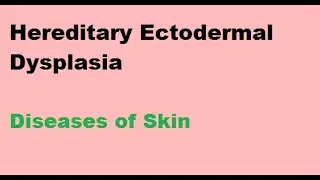 Hereditary Ectodermal Dysplasia : Diseases of Skin