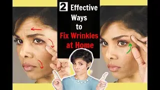 2 EFFECTIVE ways to get rid of FACE WRINKLES WITHOUT SURGERY AND BOTOX! Best anti-aging tips